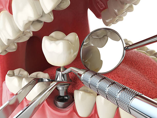 Best Emergency Broken Tooth Repair in Ellport, PA